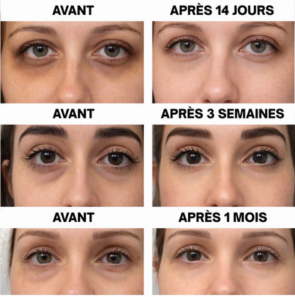Patch Yeux Régénérants au PDRN – Anti-Cernes & Anti-Poches (30 Paires)