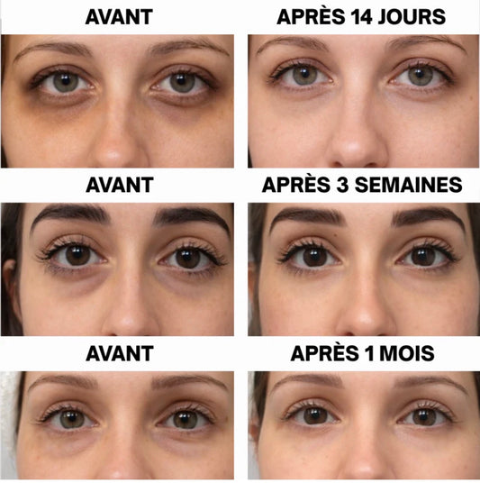 Patch Yeux Régénérants au PDRN – Anti-Cernes & Anti-Poches (30 Paires)